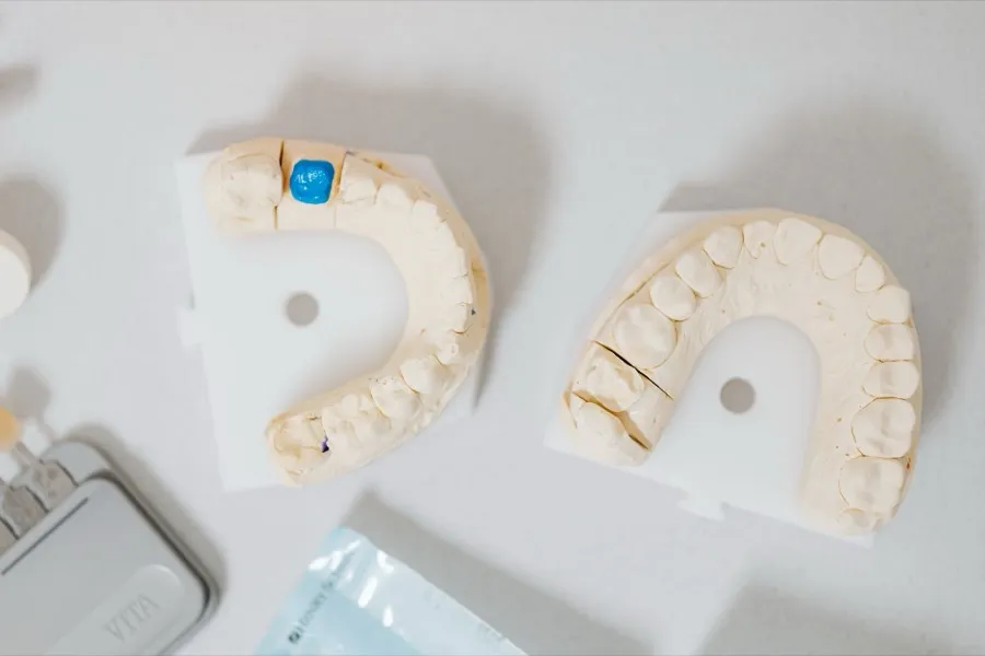 Dental impression models of upper and lower arches on a clinical surface